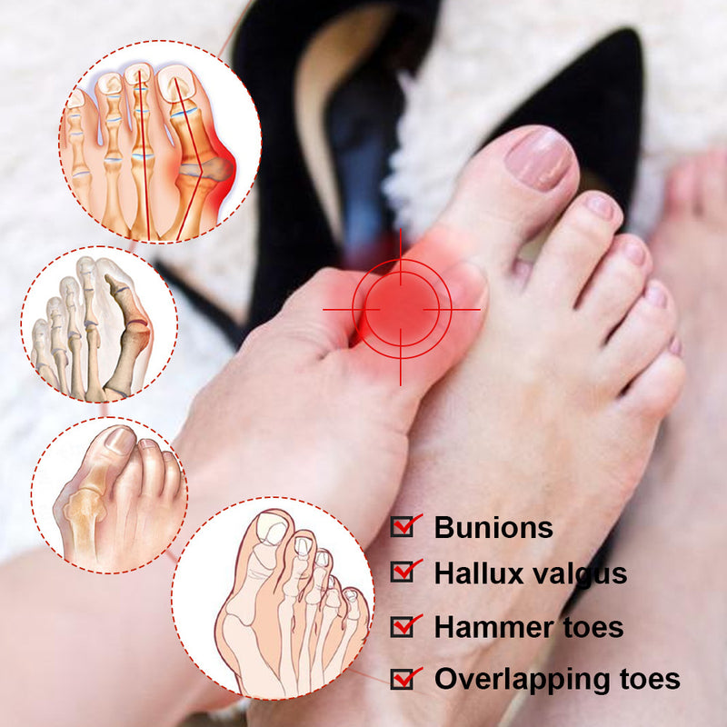 Bunion Pain Relief Patch (8 Patches) | Medicated Patch for Bunion and Gout Pains Relief