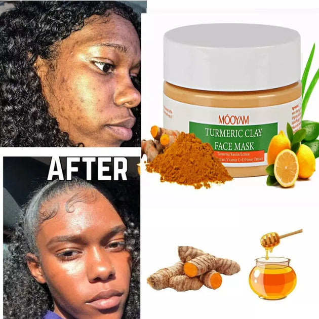 Turmeric Clay Face Mask Ginax Store