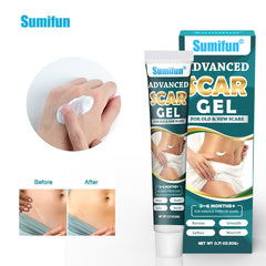 Advanced Scar Gel | Topical Cream for Old and New Scars