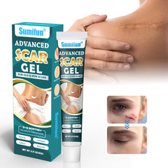 Advanced Scar Gel | Topical Cream for Old and New Scars