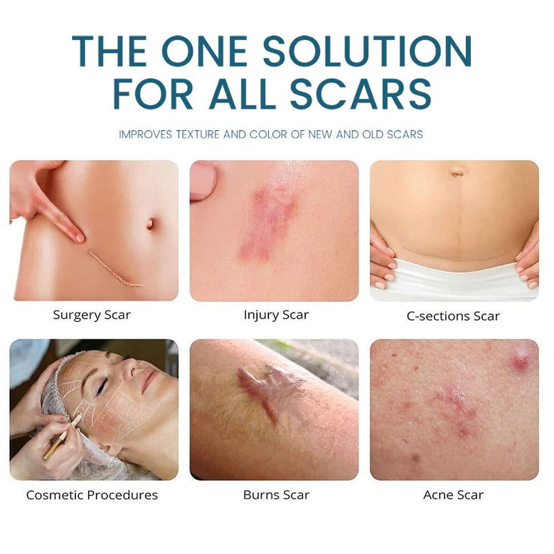 Advanced Scar Gel | Topical Cream for Old and New Scars