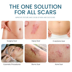 Advanced Scar Gel | Topical Cream for Old and New Scars