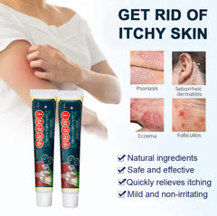 Itching Relief Cream | Topical Ointment for Psoriasis, Dermatitis, Eczema, Tinea, and Folliculitis