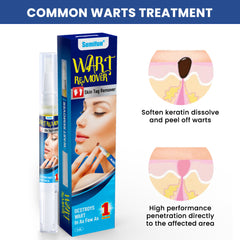 Wart Remover Pen | Skin Tag Remover