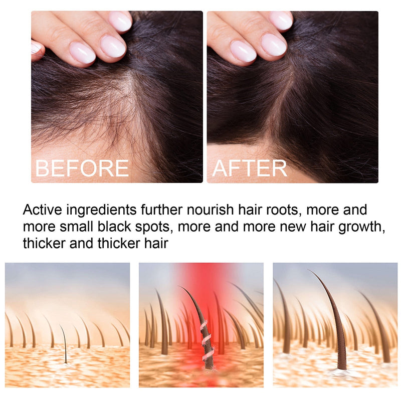 Hair Growth Serum Spray | Topical Spray for Alopecia Baldness, Hair Loss, and Hair Care