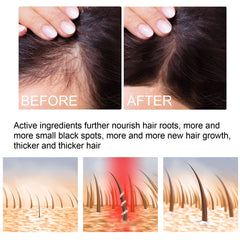 Hair Growth Serum Spray | Topical Spray for Alopecia Baldness, Hair Loss, and Hair Care