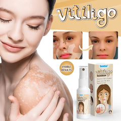 Vitiligo Removal Spray