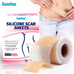 Silicone Scar Sheets (4*150cm)