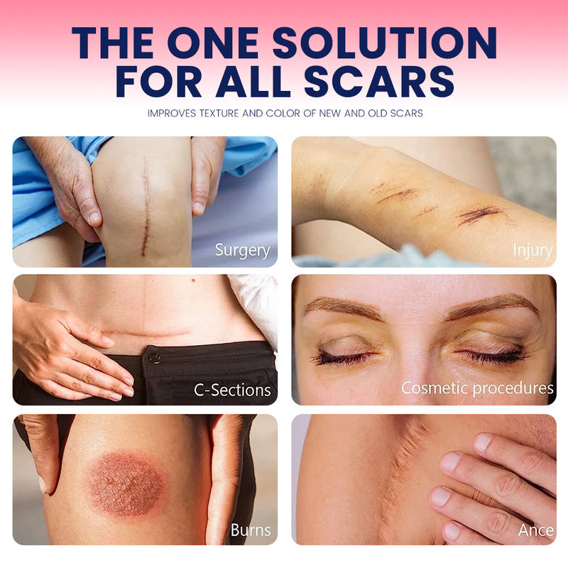 Silicone Scar Sheets (4*150cm)