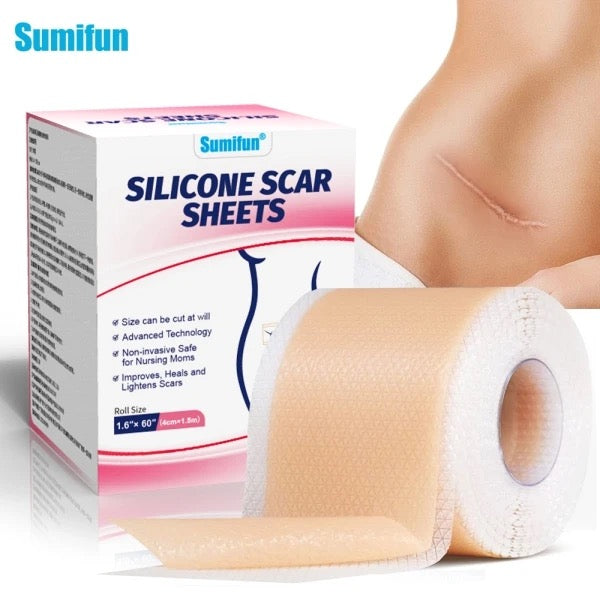 Silicone Scar Sheets (4*150cm)