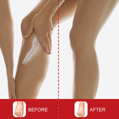 Leg Edema Relief Cream