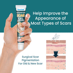 Advanced Scar Gel | Topical Cream for Old and New Scars