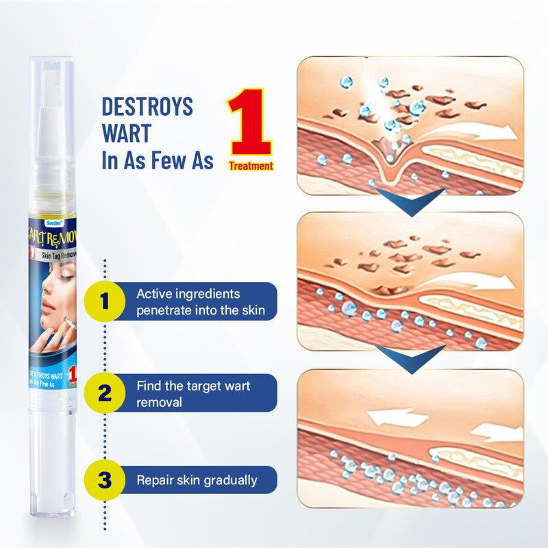 Wart Remover Pen | Skin Tag Remover