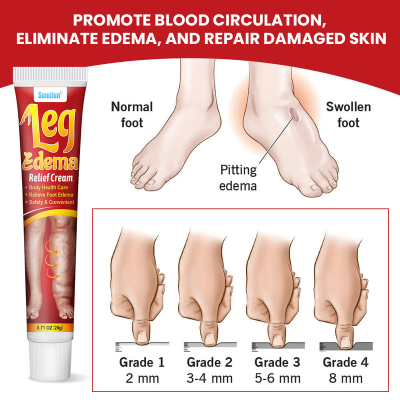 Leg Edema Relief Cream