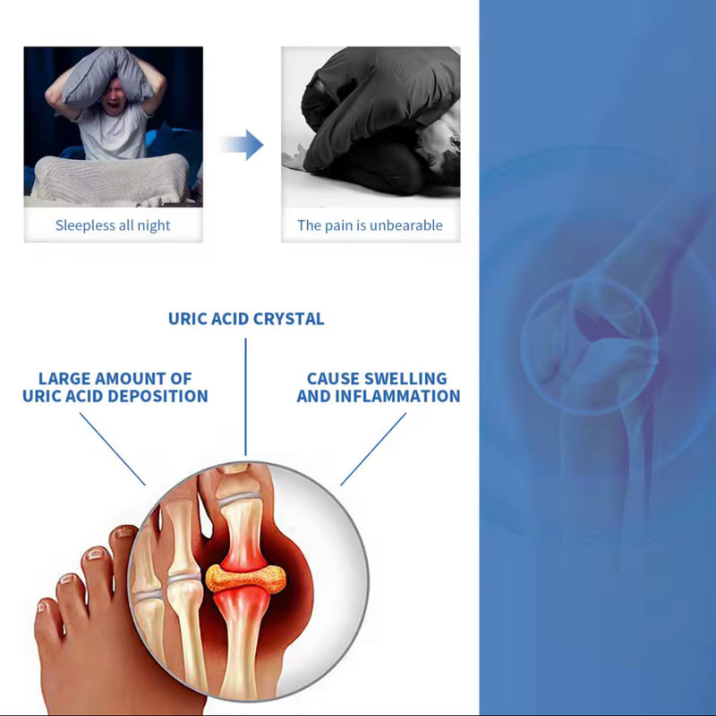 Gout Cooling Gel