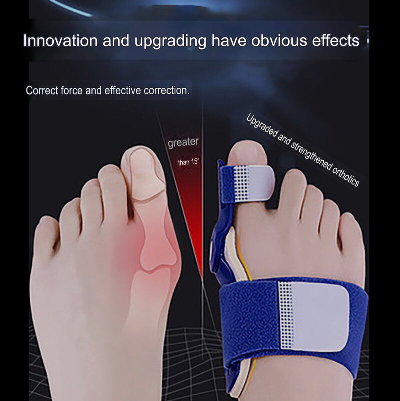 Big Toe Bunion Corrector | Hallus Valgus Corrector