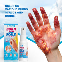 Burn and Scald Spray