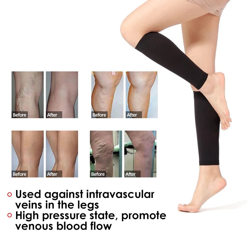 Compression Stockings For Varicose Veins: Benefits & Uses