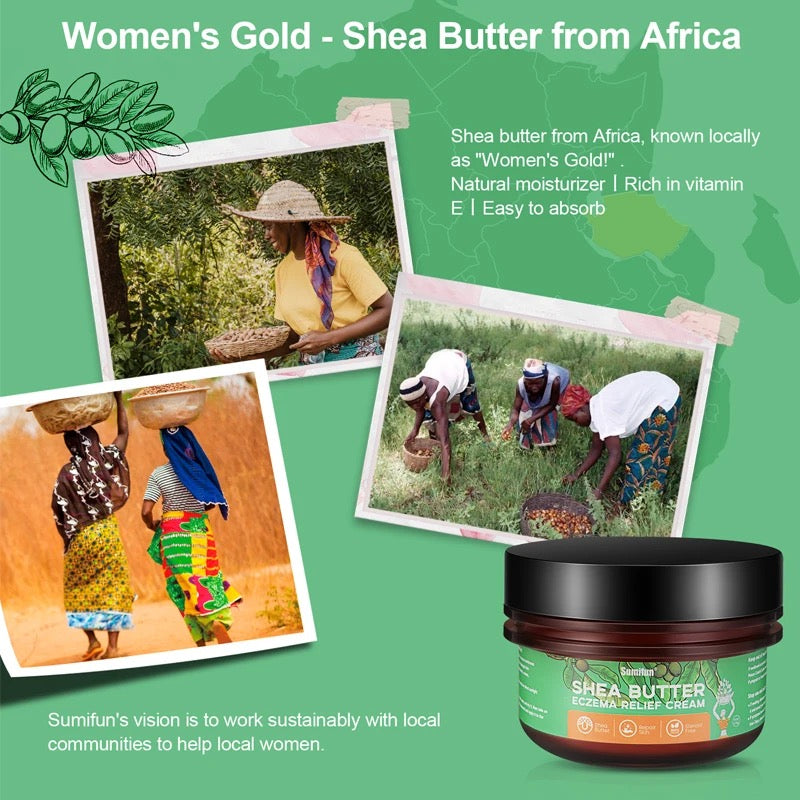 Pure African Shea Butter Cream (113g) | Topical Cream for Eczema, Psoriasis, Itching, and Dry Skin