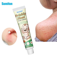 Prickly Heat Relief Cream for Babies | Topical Cream for Dermatitis, Eczema, Mosquito Bites, Itching, and Rashes