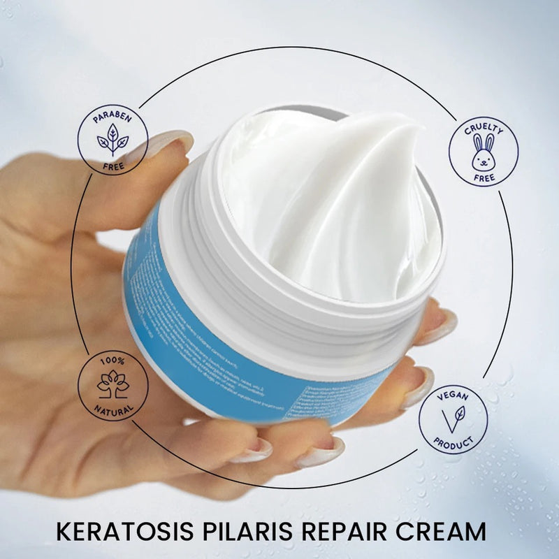 Keratosis Pilaris Repair Cream with Vitamin E and Urea (30 grams) | Topical Cream for Goosebumps, Large Skin Pores, Dark and Rough Skin