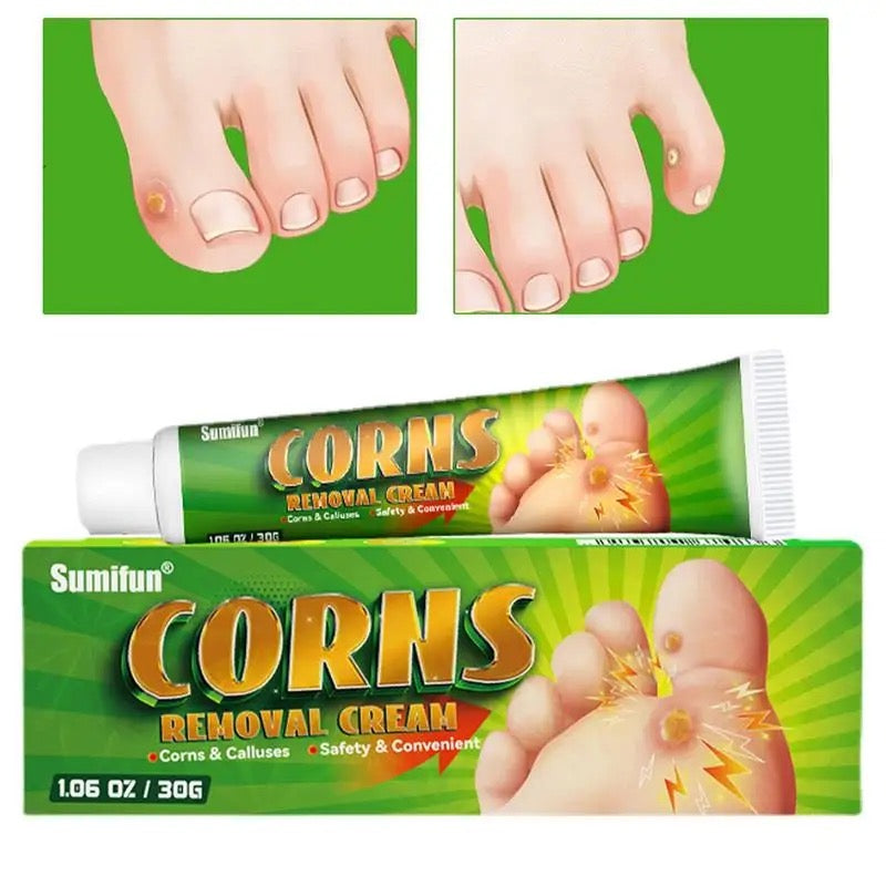 Ointment M.O. Pig Warts Corns on feet