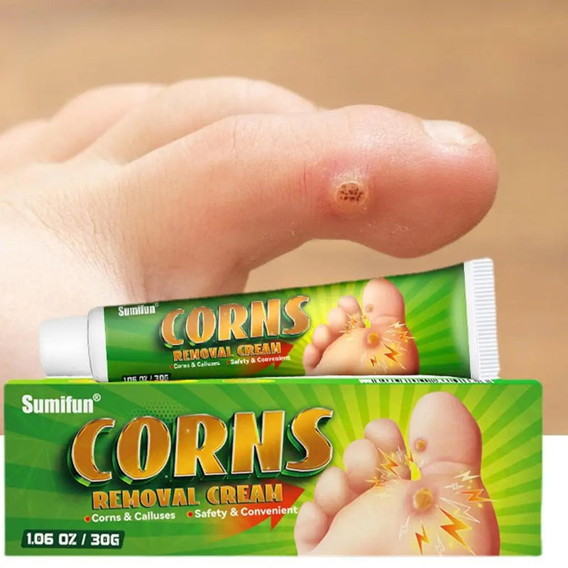 Corns Removal Cream | Topical Cream for Foot Warts, Foot Corns, and Calluses