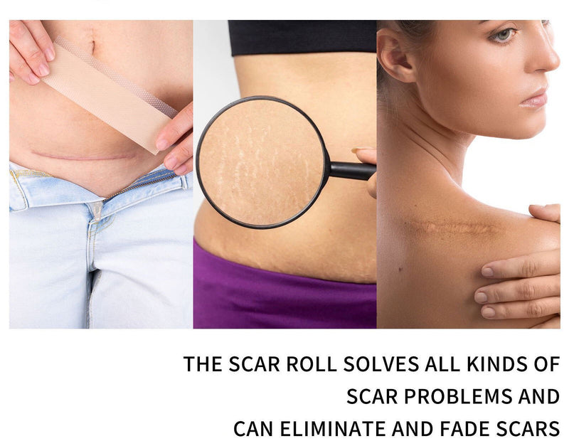 Silicone Scar Sheets (4*150cm)