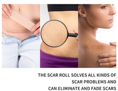 Silicone Scar Sheets (4*150cm)