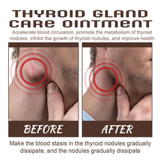 Thyroid Gland Care Ointment | Topical Ointment for Goiter, Swollen Throat, and Nodule Pain