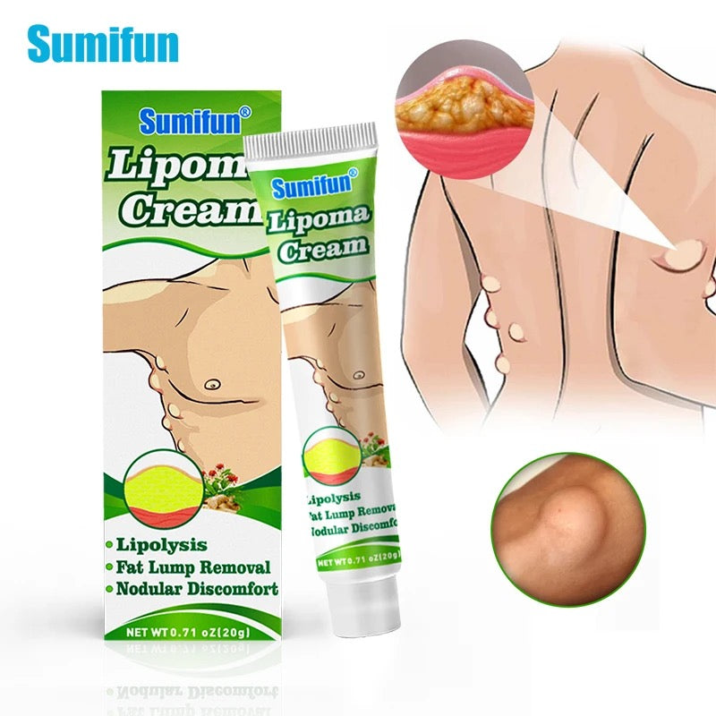 Lipoma Cream | Herbal Ointment for Skin Lump, Benign Lipoma and Tumor