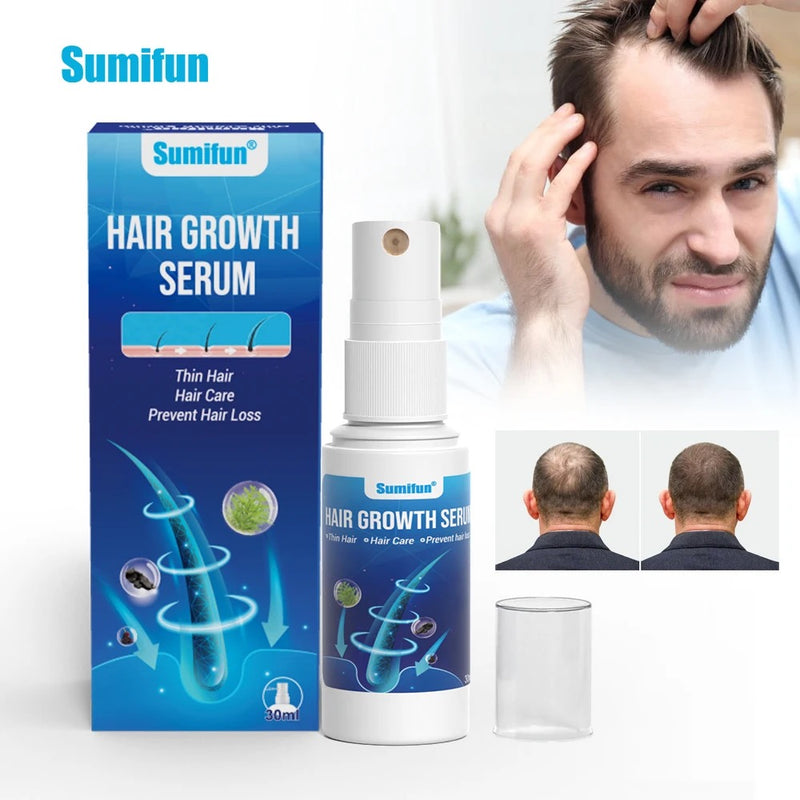 Hair Growth Serum Spray | Topical Spray for Alopecia Baldness, Hair Loss, and Hair Care
