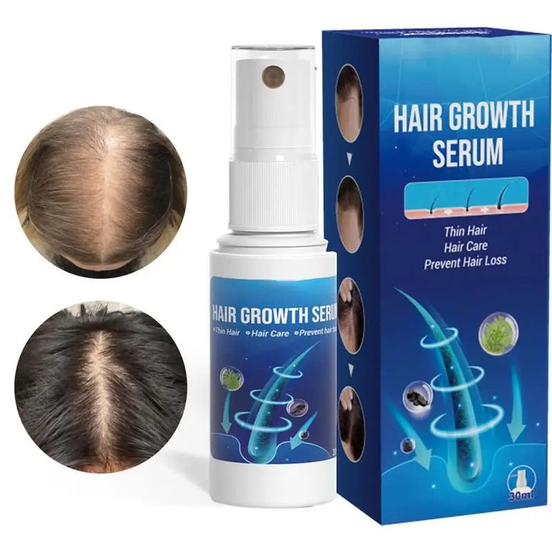 Hair Growth Serum Spray | Topical Spray for Alopecia Baldness, Hair Loss, and Hair Care