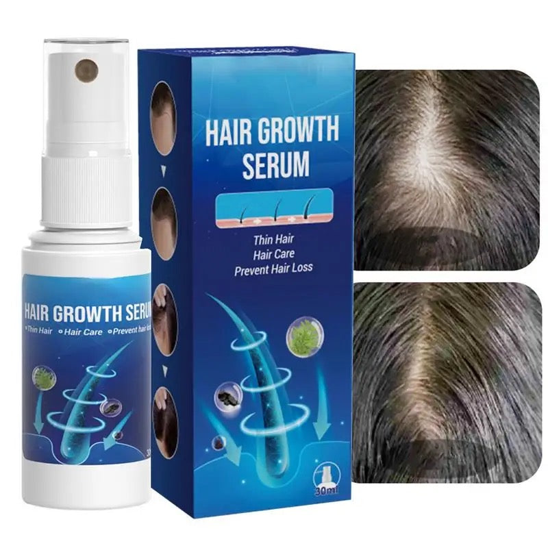 Hair Growth Serum Spray | Topical Spray for Alopecia Baldness, Hair Loss, and Hair Care