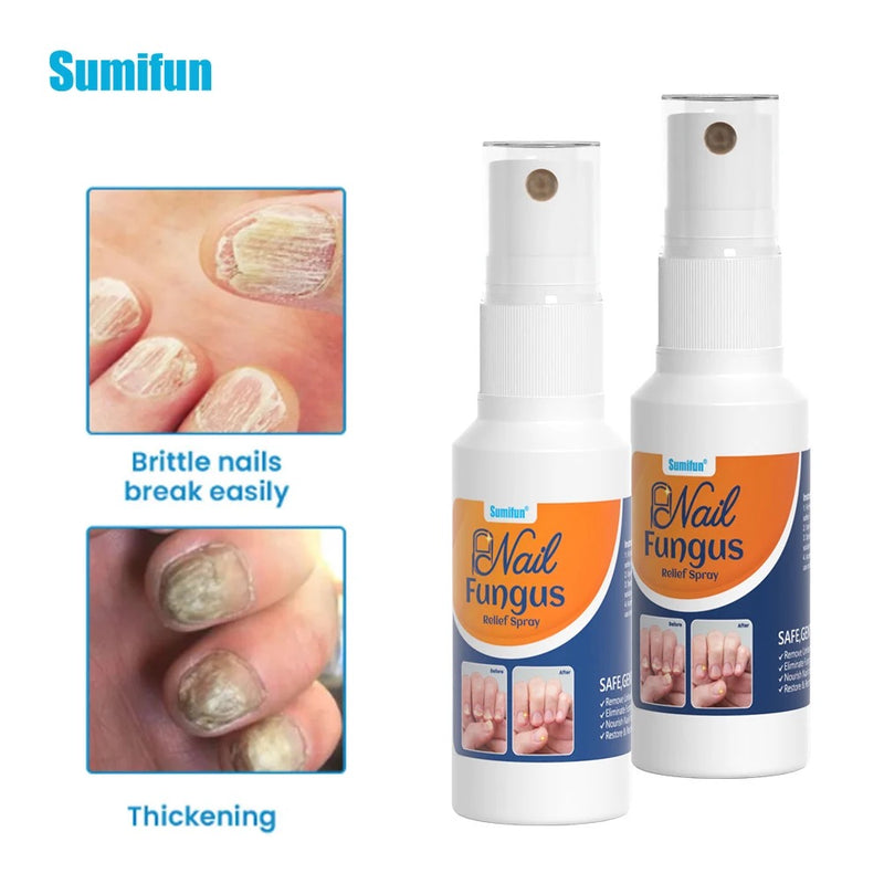 Nail Fungus Relief Spray | Topical Spray for Infected, Damaged and Discolored Nails