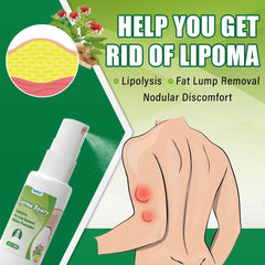 Lipoma Spray | Topical Spray for Skin Lump, Benign Lipoma and Tumor