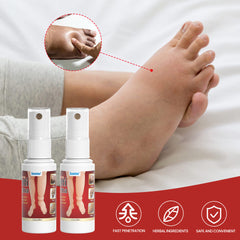 Anti-Edema Spray | Topical Spray for Foot Edema