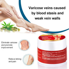 Varicose Veins Miracle Cream (10 grams) | Herbal Cream for Spider and Varicose Veins