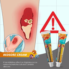 Bed Sores Cream | Herbal Ointment for Decubitus Ulcers, Wound Healing, and Pressure Ulcers