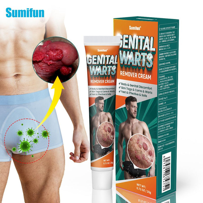 Genital Warts Remover Cream