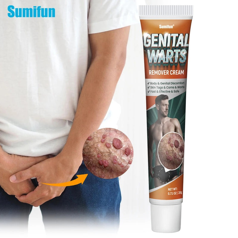 Genital Warts Remover Cream