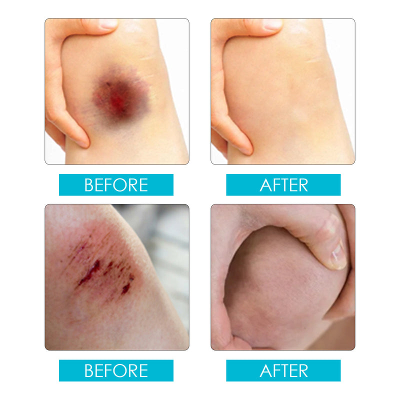 Liquid Wound Dressing | Liquid First Aid for Cuts and Wounds