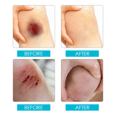 Liquid Wound Dressing | Liquid First Aid for Cuts and Wounds