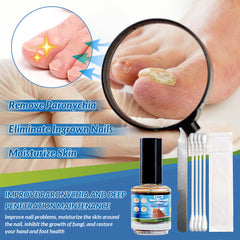 Nail Fungus Liquid (15ml) | Topical Ointment for Ingrown Nails, Brittle Nails, Thick Nails, Sinking Nails, and Discolored Nails