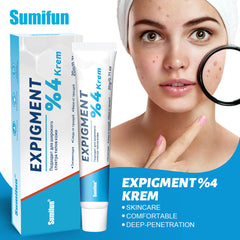 Expigment Cream (4% hydroquinone) | Topical Cream for Dark Spots, Acne Spots, Sun Spots, Age Spots, and Melasma
