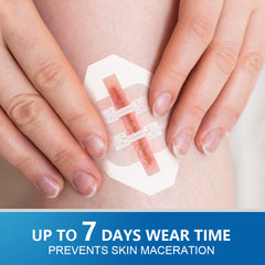 Zipper Strip Skin Closure for Wound Dressing (2 pieces)