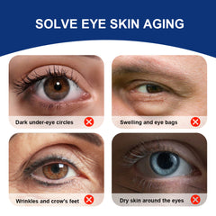 Under Eye Cream for Dark Circles | Topical Cream for Wrinkles, Eye Bags, and Dry Skin Around the Eyes