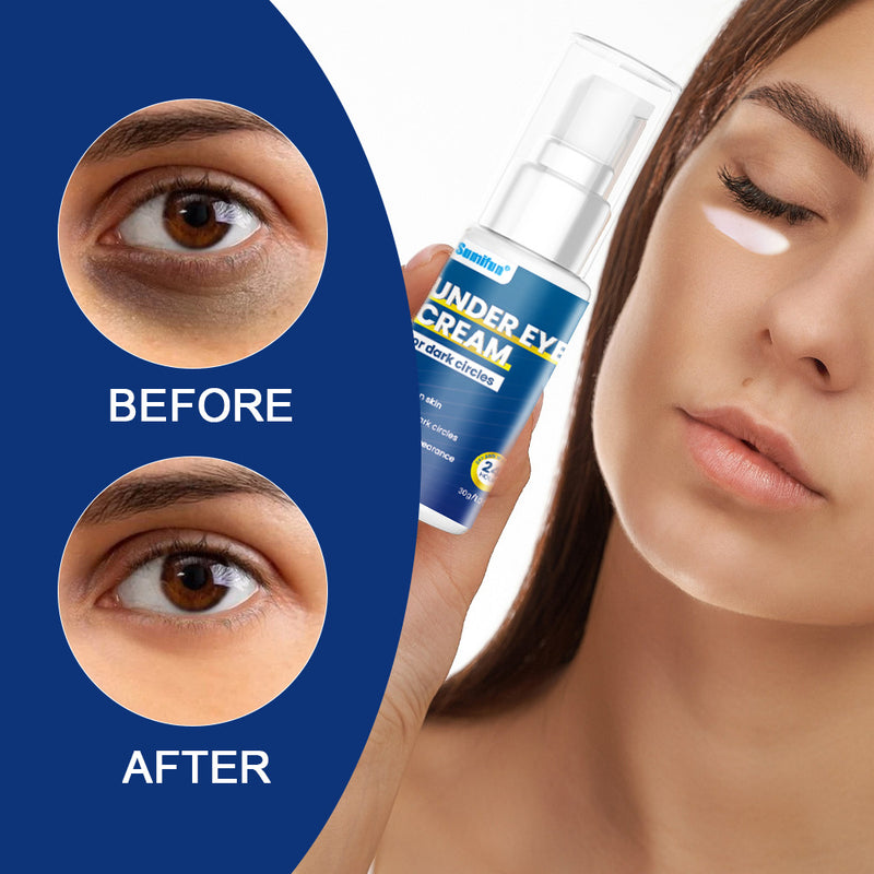 Under Eye Cream for Dark Circles | Topical Cream for Wrinkles, Eye Bags, and Dry Skin Around the Eyes