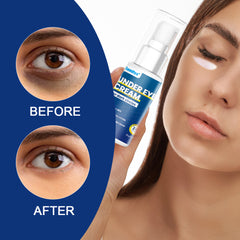 Under Eye Cream for Dark Circles | Topical Cream for Wrinkles, Eye Bags, and Dry Skin Around the Eyes