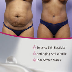 BIYODE Stretch Mark Oil (100ml) | Topical Oil for Scars, Stretch Marks, and Skin Elasticity